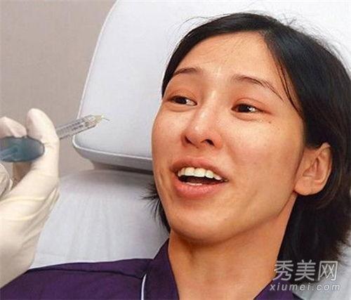 明星整容打针,揭秘整容打针背后的真相与风险