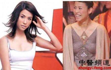 胸下垂 明星,揭秘胸下垂明星的美丽蜕变之路